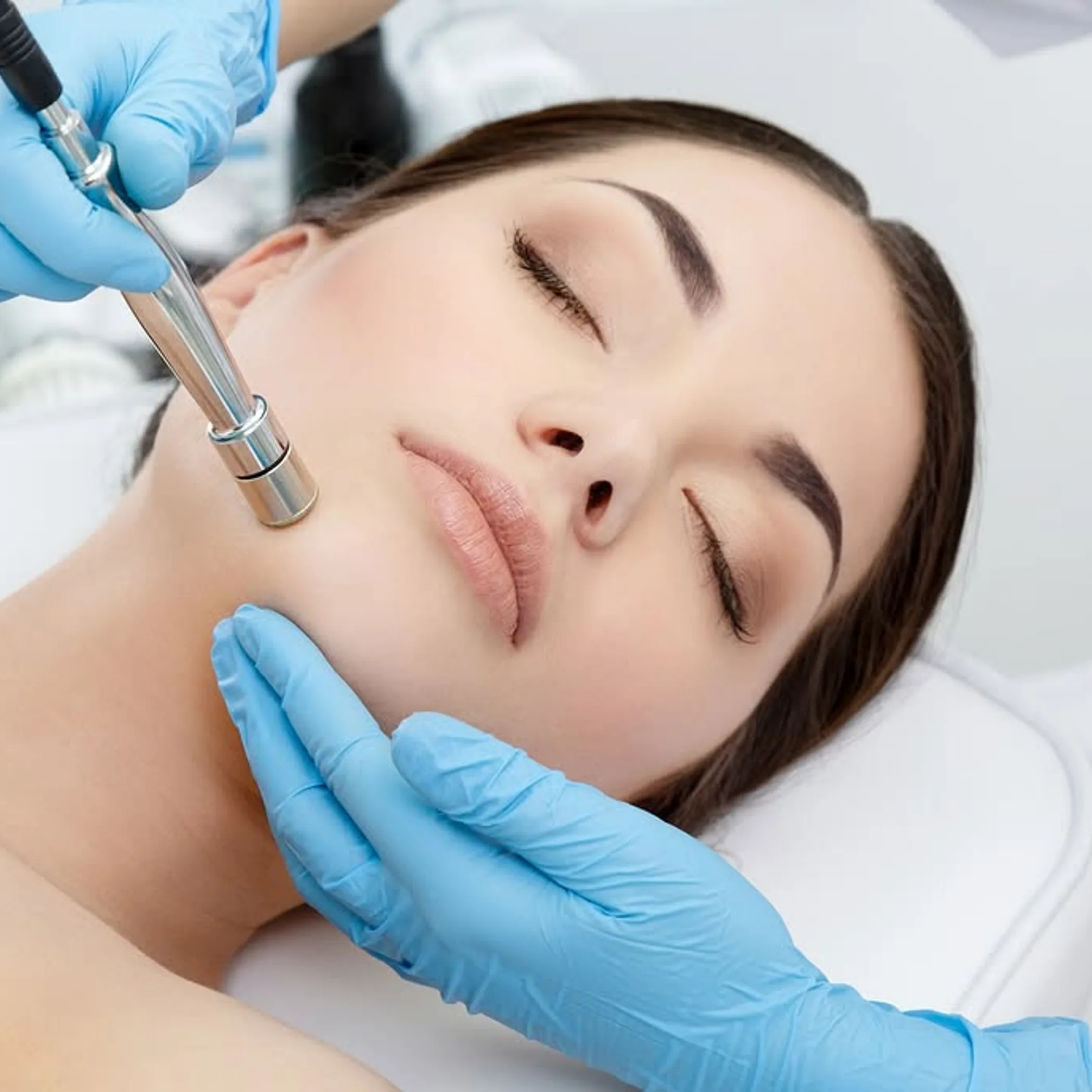 skin resurfacing procedure