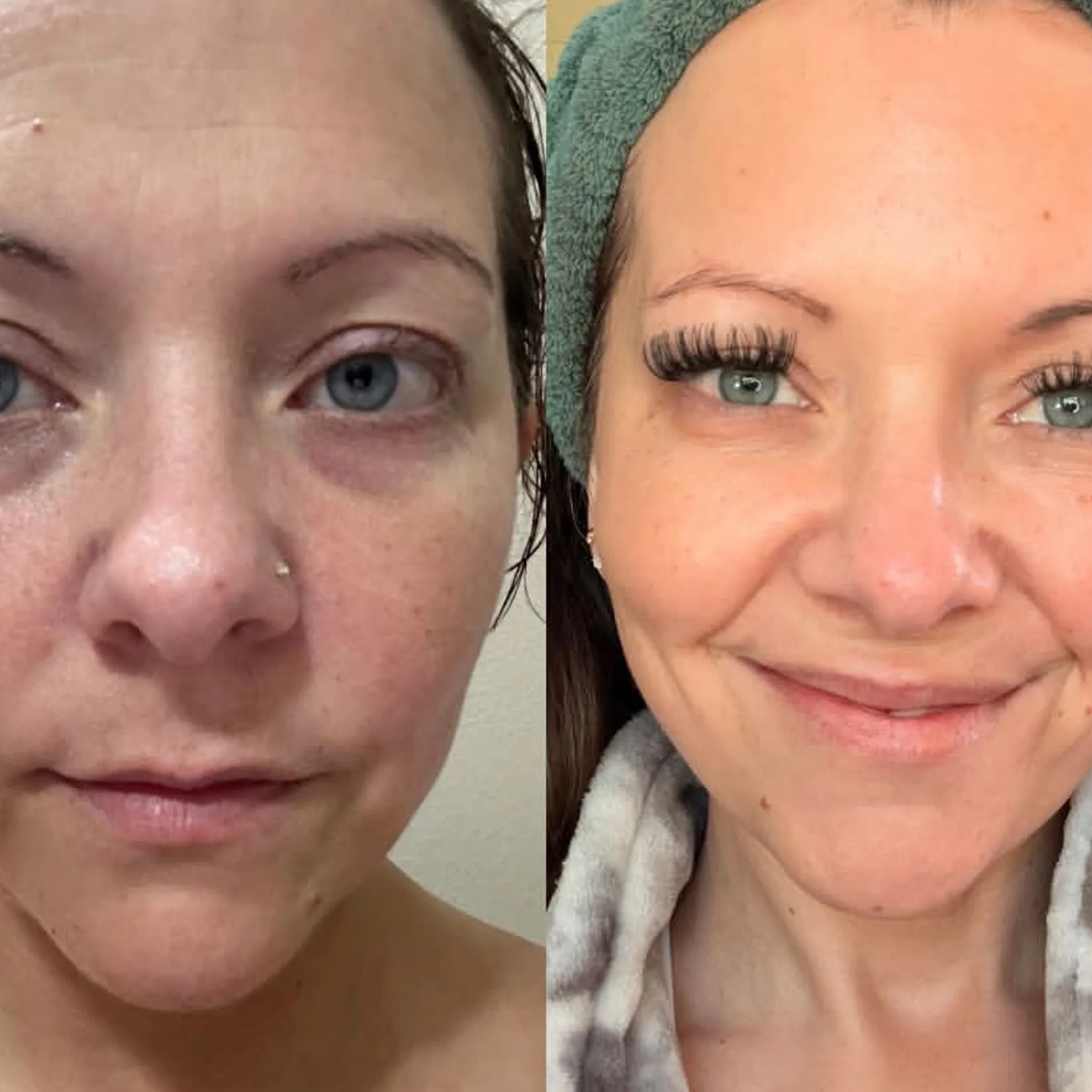 skin health and visible aging changes