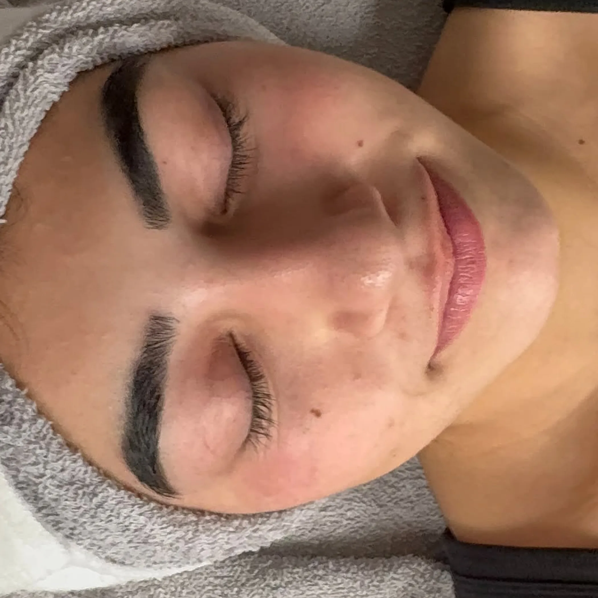 clean, well-lit facial skincare results